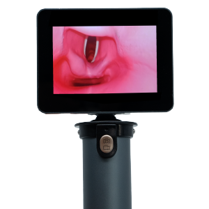 MDPro EZ Vision Video Laryngoscope