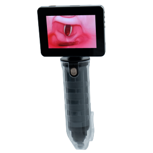 MDPro EZ Vision Video Laryngoscope